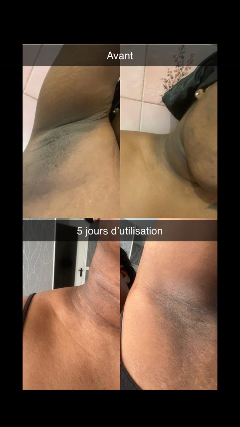 Customer photo review of Savon visage biscuit