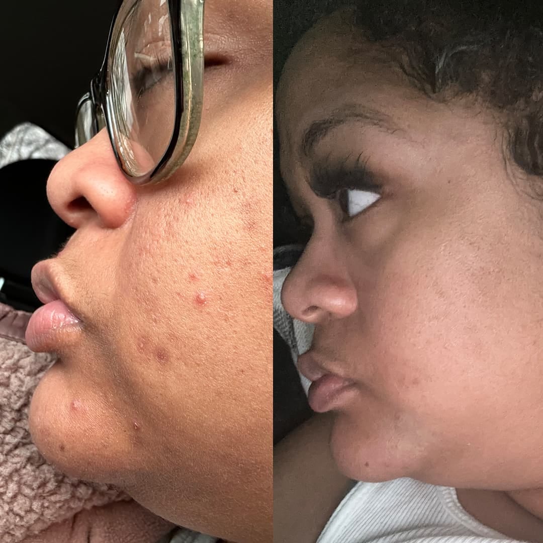 Customer photo review of Turmeric Collagen Facial Mask