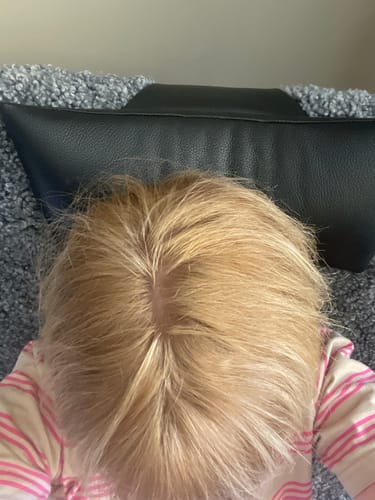 Customer photo review of Sunkissed Starter Kit