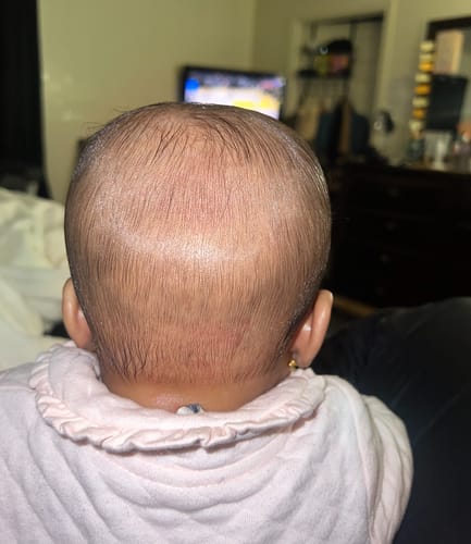 Customer photo review of Infant Collection Kit