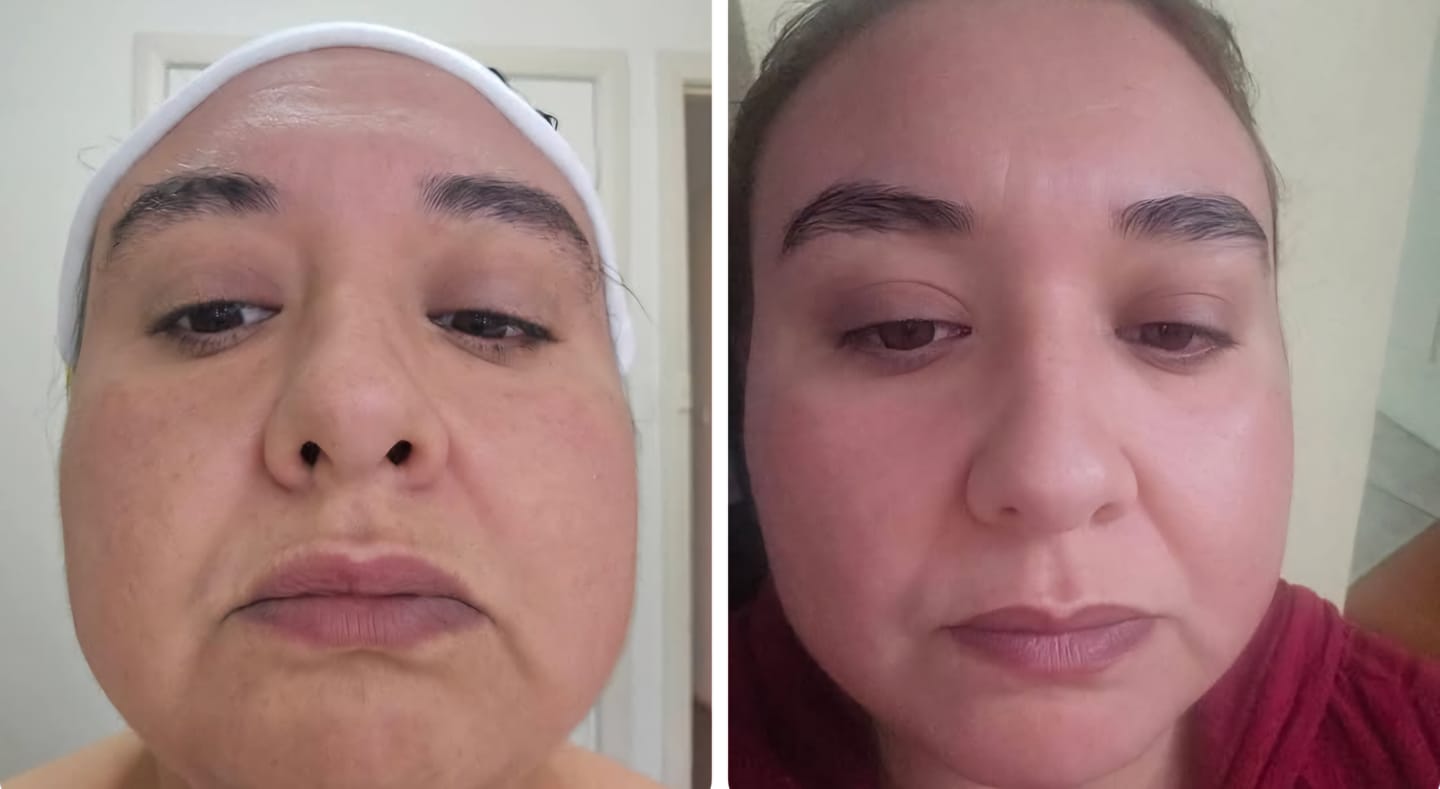 Customer photo review of ⚡ Australia’s Turmeric Clay Mask