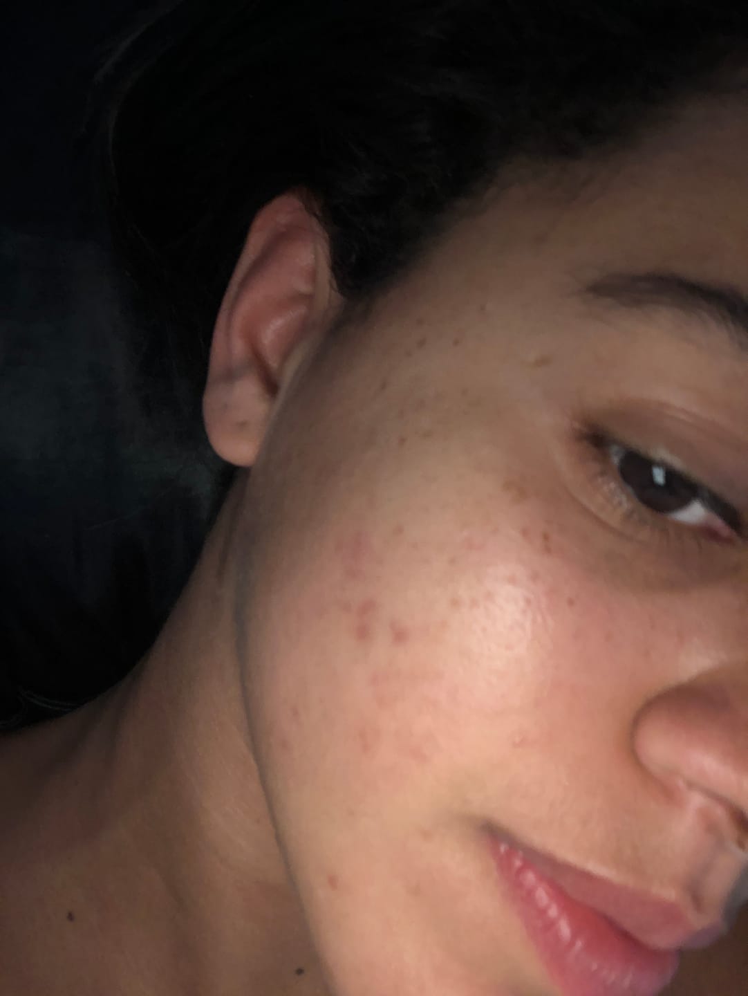 Customer photo review of Gel de Limpeza Facial Pele de Pêssego