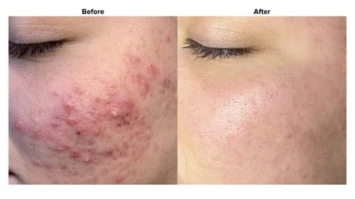 Customer photo review of Turmeric Collagen Facial Mask