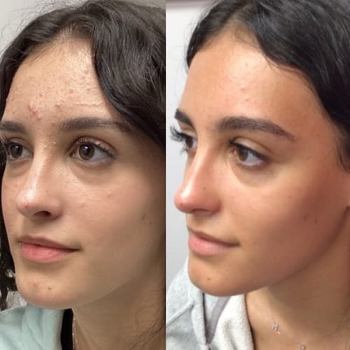 Customer photo review of Turmeric Collagen Facial Mask