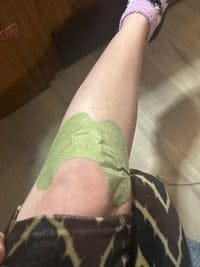 Customer photo review of ReliveX™ Knie Pleisters