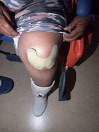 Customer photo review of ReliveX™ Knie Pleisters