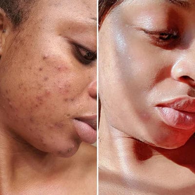 Customer photo review of Turmeric Collagen Facial Mask