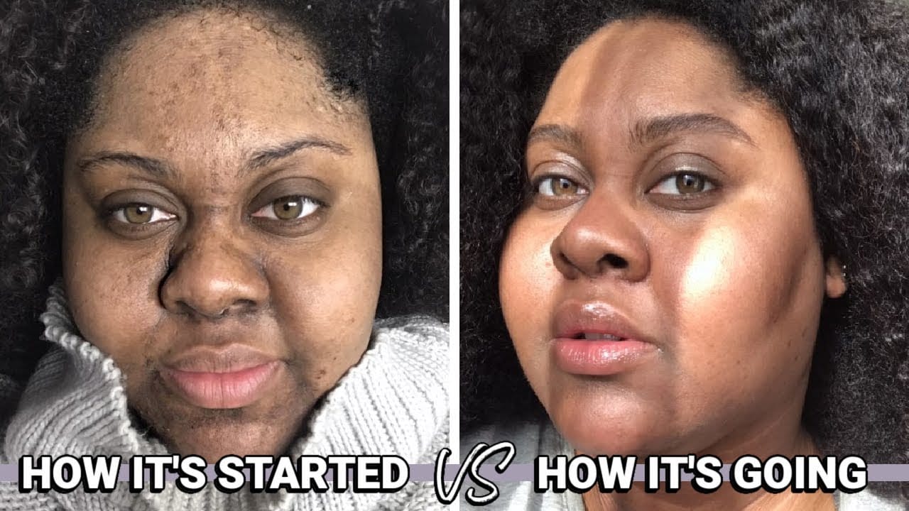 Customer photo review of Turmeric Collagen Facial Mask