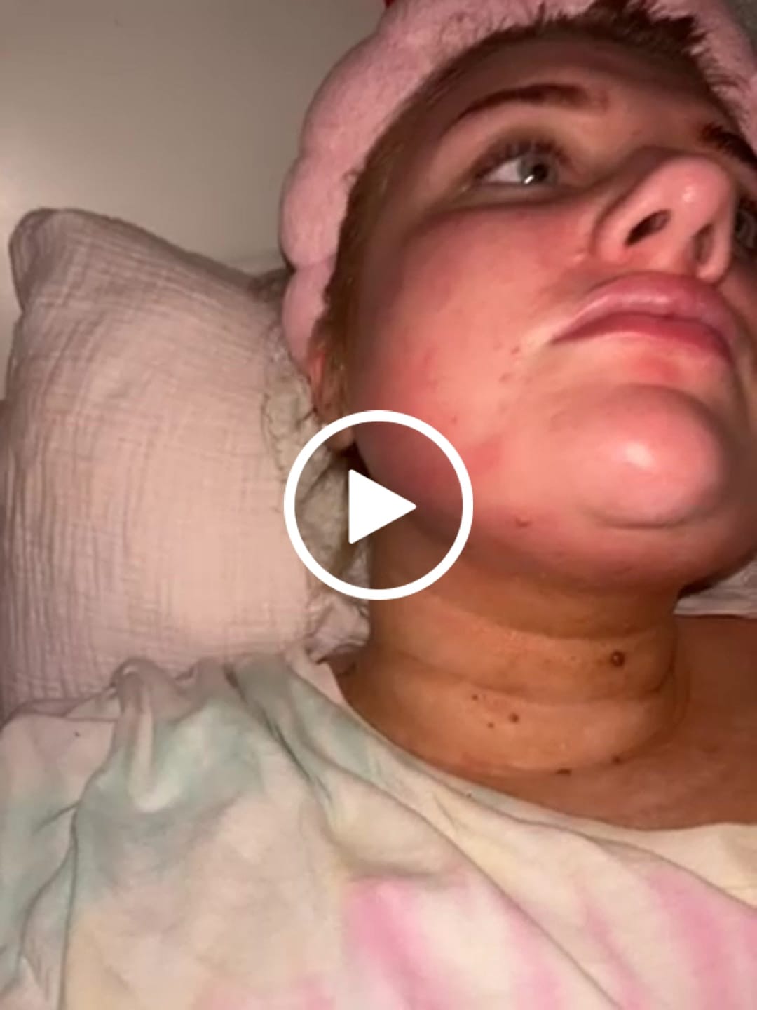 Customer video review of P.Louise Peel The Love Peel Off Face Mask