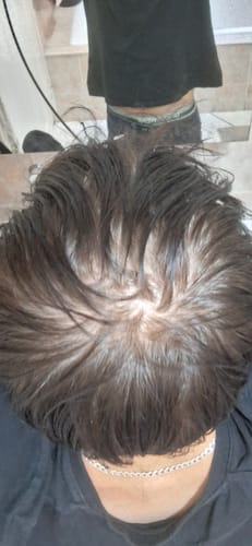 Customer photo review of Minoxi5 Double Action for MEN, 3 PACK