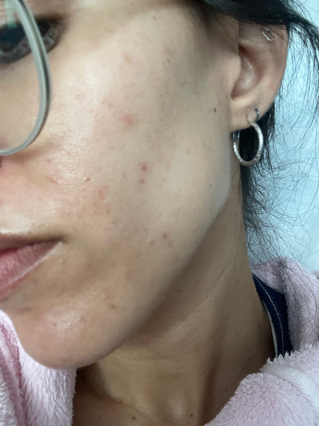 Customer photo review of RUTINA AM&PM - GRANITOS + MARCAS + POROS + MANCHAS + ARRUGAS
