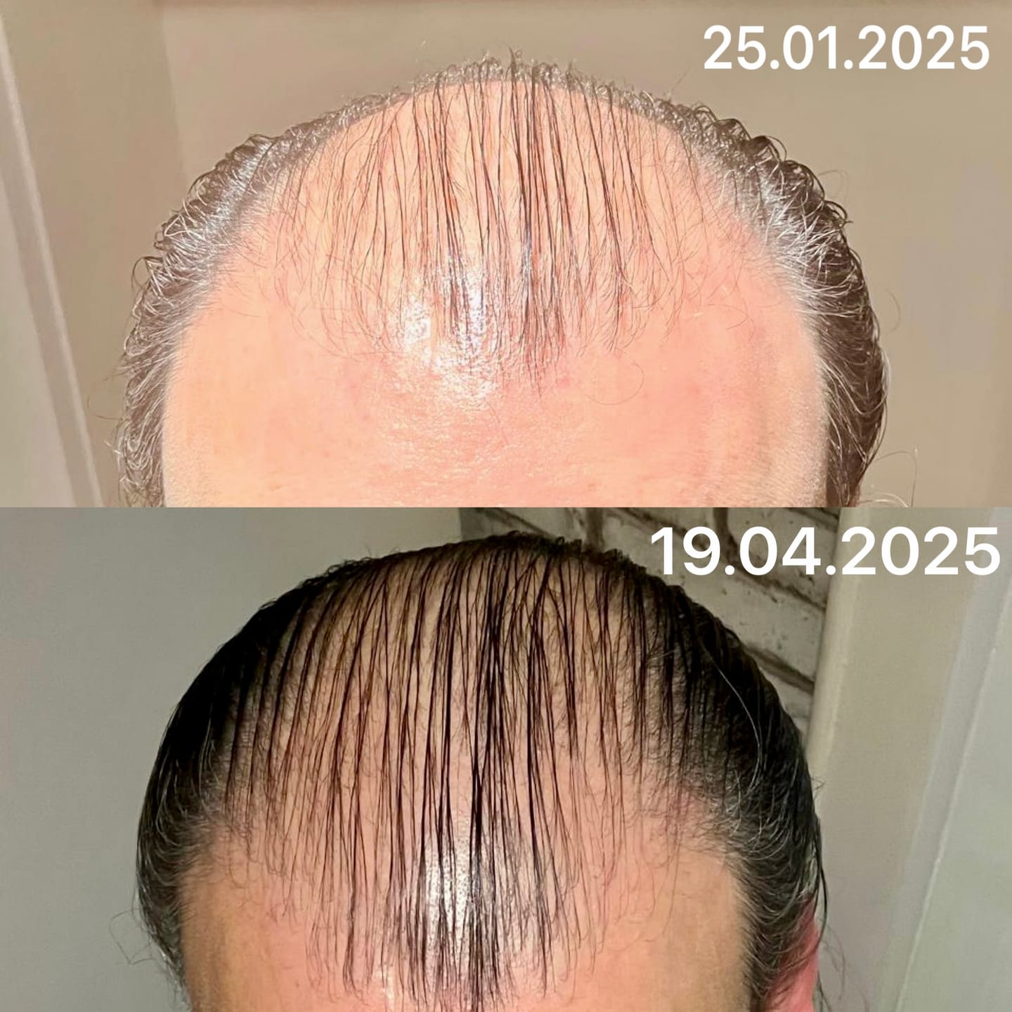 Customer photo review of TRÈS[S] GROWN - Hair Growth Serum