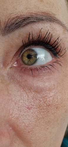 Customer photo review of iGlow Lash Maximizer - Lash Serum, 3 ml