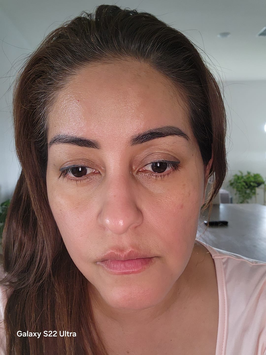 Customer photo review of INIA LUMIN Eye Skincare Device