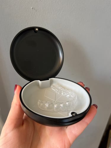 Customer photo review of Lower Essix Retainer