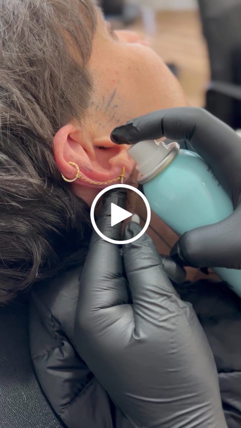Customer video review of Ultimate Keloid Scar Trio