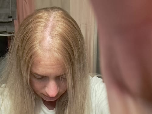 Customer photo review of Sunkissed Starter Kit