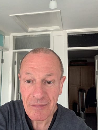 Customer photo review of Pure Apigenin Supplement