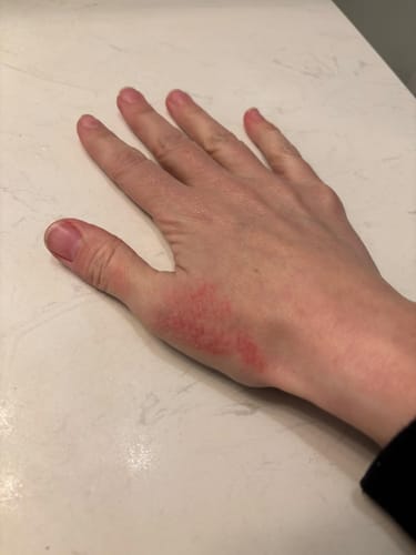 Customer photo review of F-Balm - Premium Anti-aging Tallow Balm 2 oz. Tin