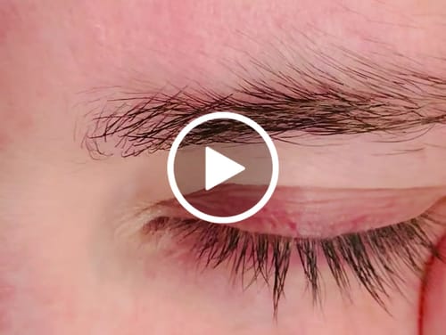 Customer video review of LASHCOCA!NE - Wimpernserum