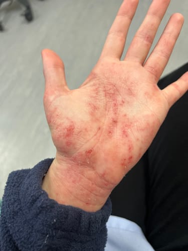 Customer photo review of The Soothe Blend