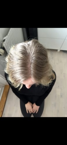 Customer photo review of Sunkissed Starter Kit