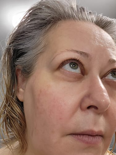 Customer photo review of F-Balm - Premium Anti-aging Tallow Balm 2 oz. Tin