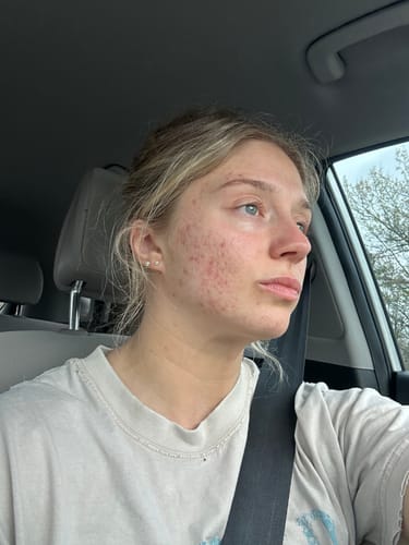 Verified customer photo submitted with an AndroEase review
