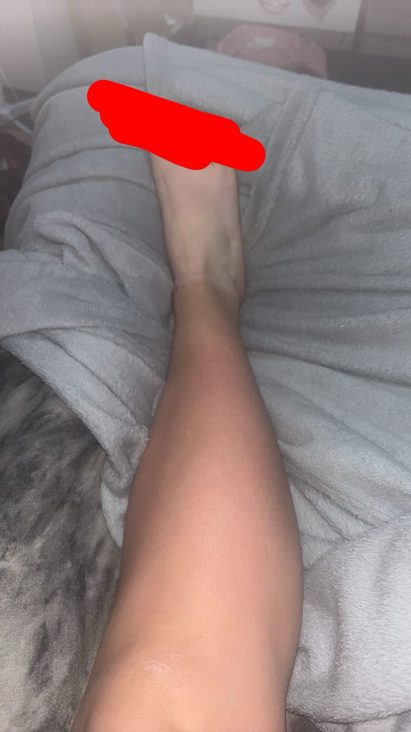Customer photo review of **Pre Order** RAPID TAN - VANILLA BABY - ADVANCED TANNING ACCELERATOR