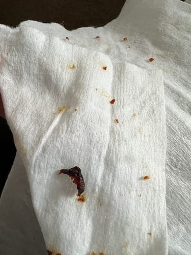 Customer photo review of ClearEar™ Earwax Removal Kit