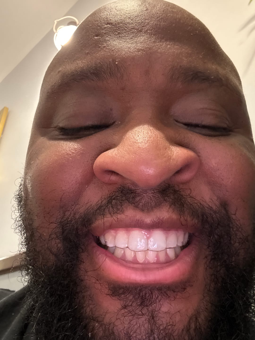 Customer photo review of REORDER-Upper Retainer