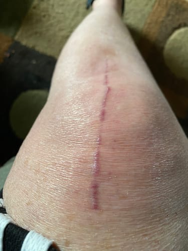 Customer photo review of Combat Ready Ointment - Triple Threat