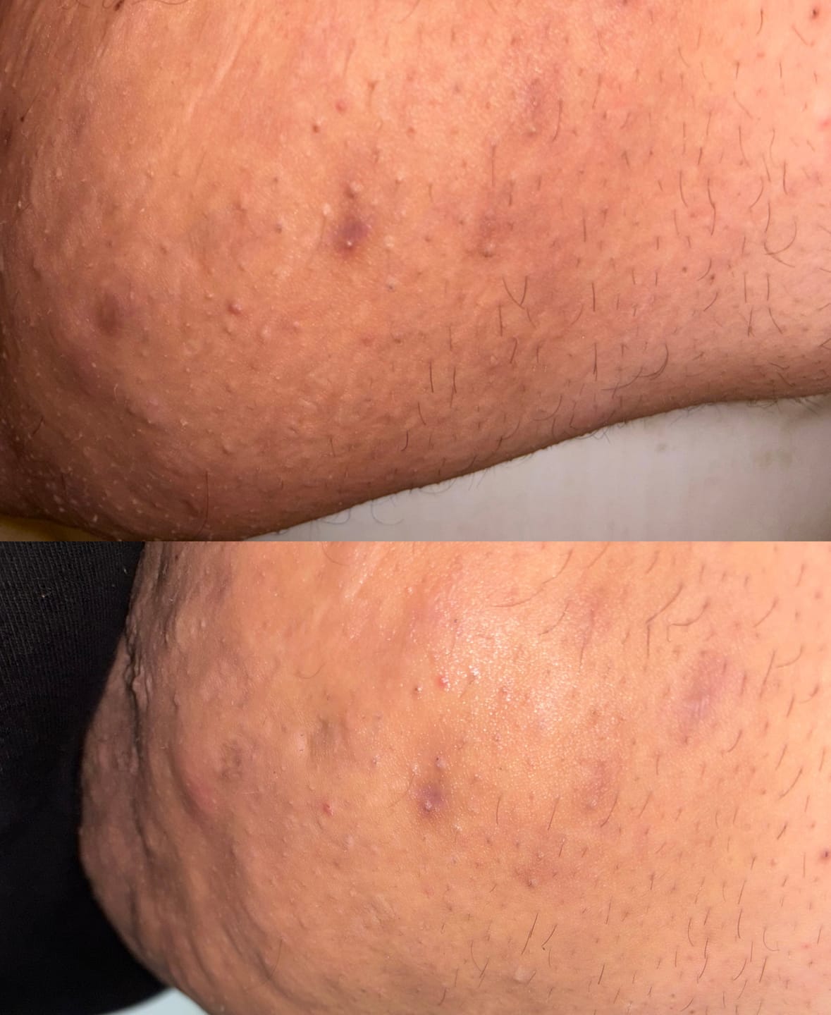 Customer photo review of Brufostop Body