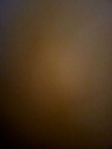 Customer photo review of ClearEar™ Earwax Removal Kit
