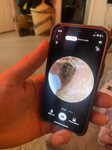 Customer photo review of ClearEar™ Earwax Removal Kit