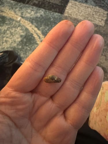 Customer photo review of ClearEar™ Earwax Removal Kit