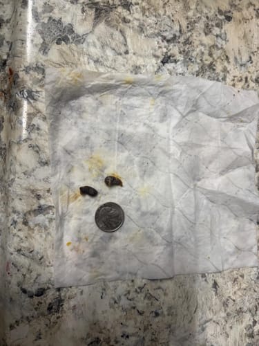 Customer photo review of ClearEar™ Earwax Removal Kit
