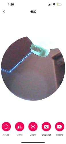Customer photo review of ClearEar™ Earwax Removal Kit