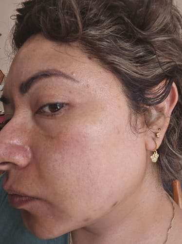 Customer photo review of Formula Personalizada (Rx)