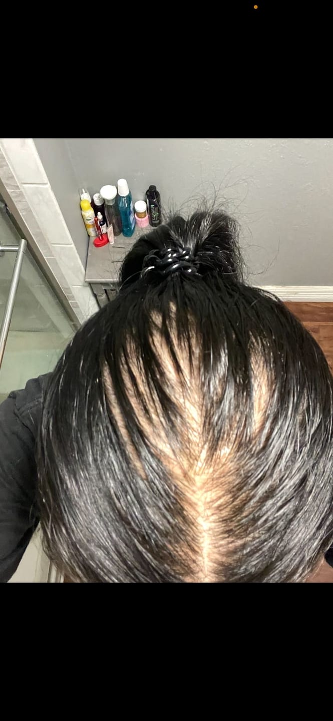 Customer photo review of Complex10™ Hair Growth Supplement