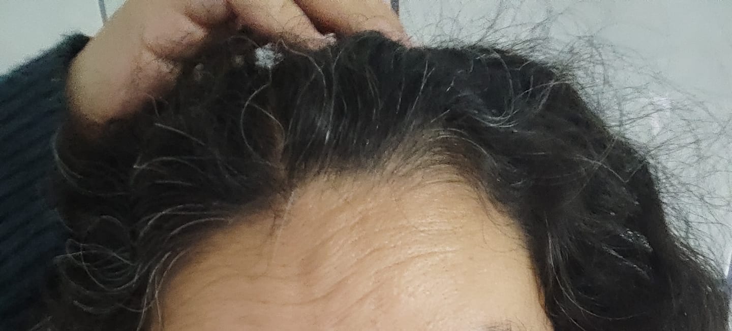 Customer photo review of Polvo de Índigo