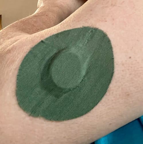Customer photo review of Skin Grip Original - Dexcom G7 & Stelo Adhesive Patches