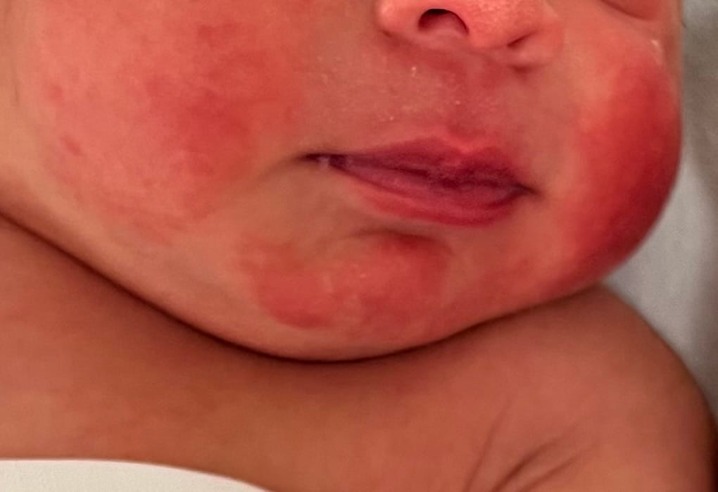 Customer photo review of Manuka Moisturising Baby Butter