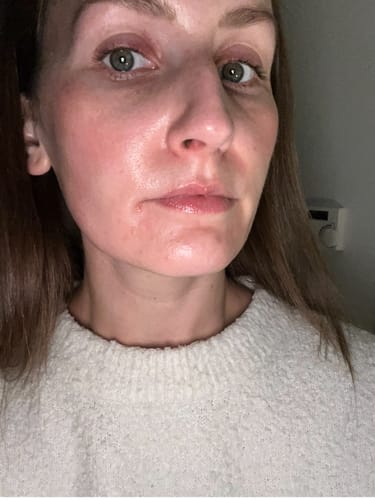 Customer photo review of 5-Step Clear Skin Kit