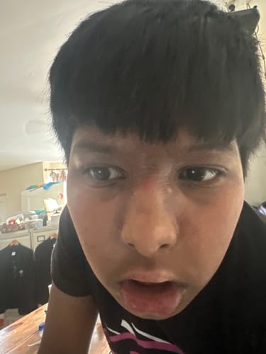 Customer photo review of Calm Balm