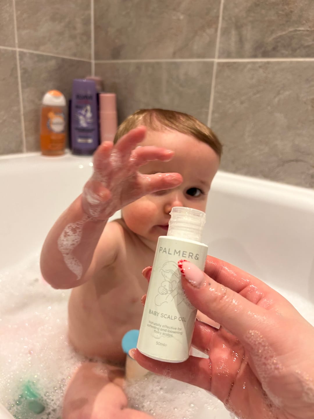 Customer photo review of Baby Scalp Oil