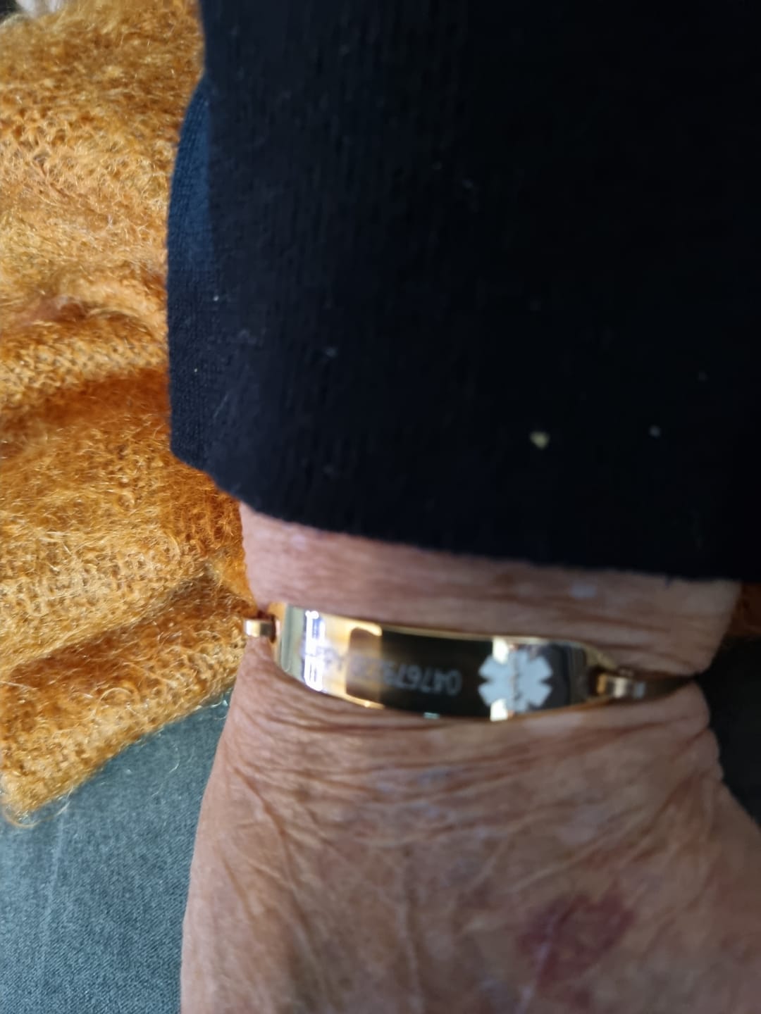 Customer photo review of Personalised Rose Gold Medical Alert ID Bangle Bracelet