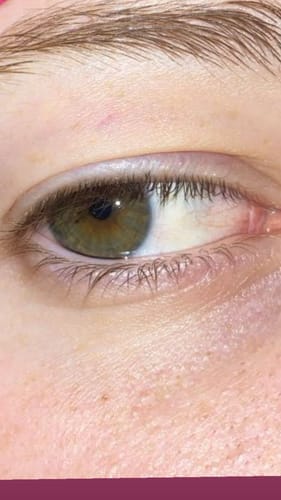 Customer photo review of Lash Growth Serum