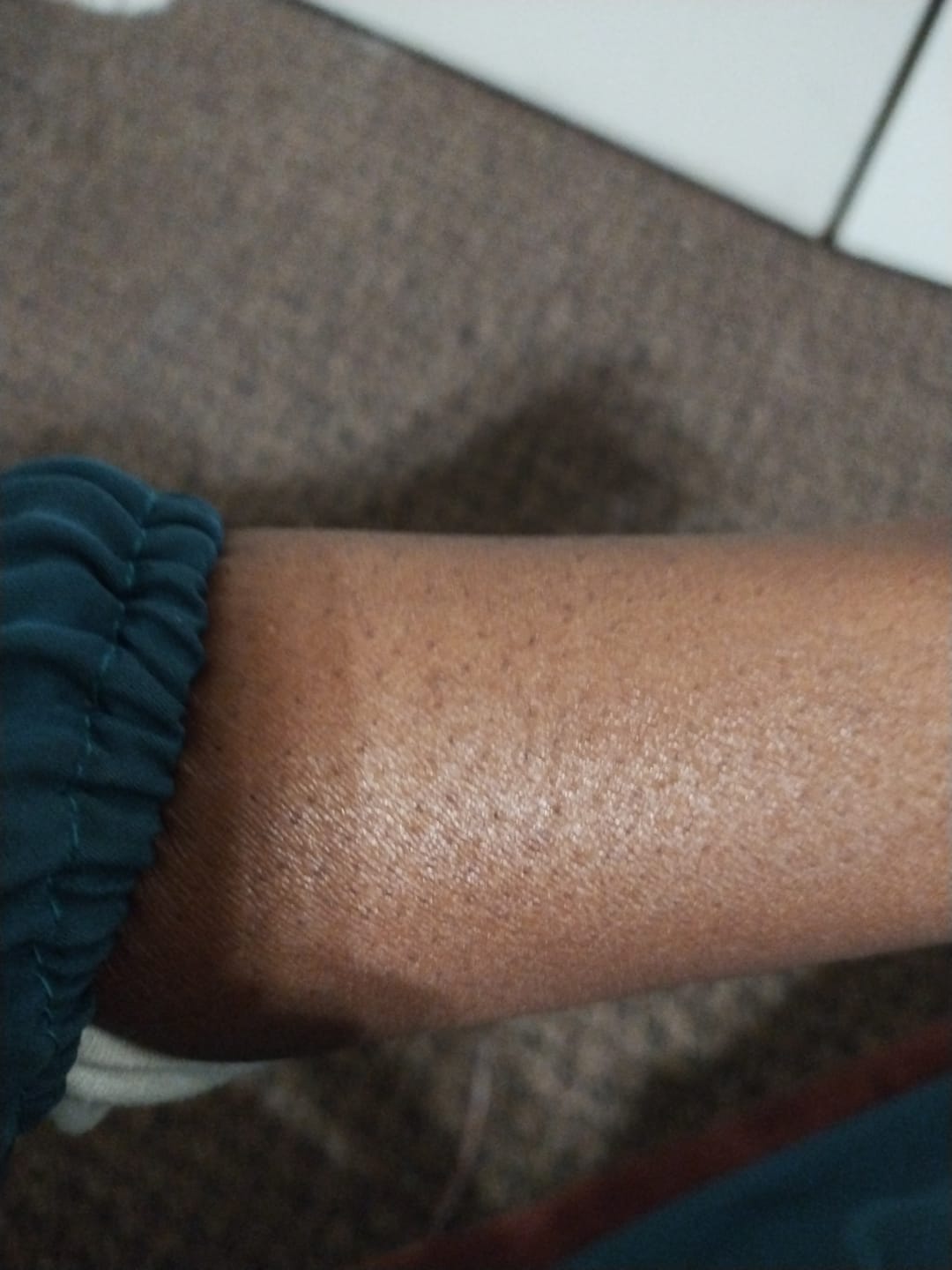 Customer photo review of LightenUp PLUS Active Lightening Cream - 100ml / 3.4 Oz