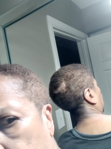 Customer photo review of Rennora Hair Growth Serum